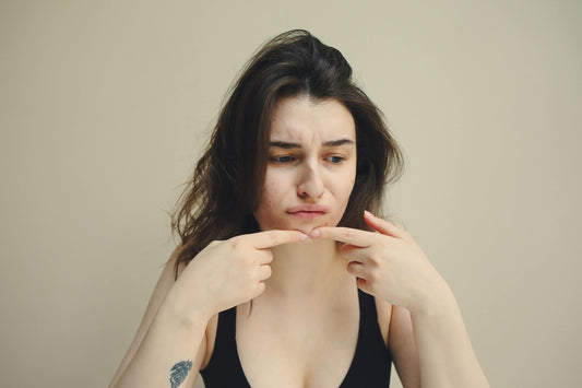 Your Skin Feels Everything: How Stress Shows Up on Your Face